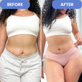 LUMA Pro - Ultrasonic Body Toner & Cellulite Remover